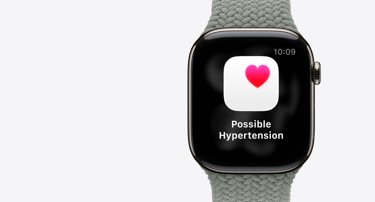 Apple Watch Series 11, фото 27